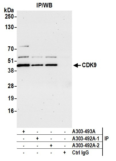 CDK9 Antibody in Immunoprecipitation (IP)