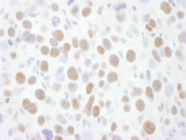 CDK9 Antibody in Immunohistochemistry (Paraffin) (IHC (P))