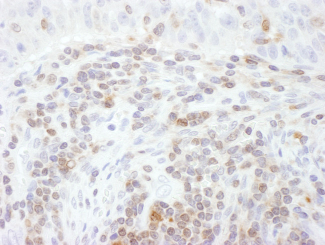 STAT5a Antibody in Immunohistochemistry (Paraffin) (IHC (P))