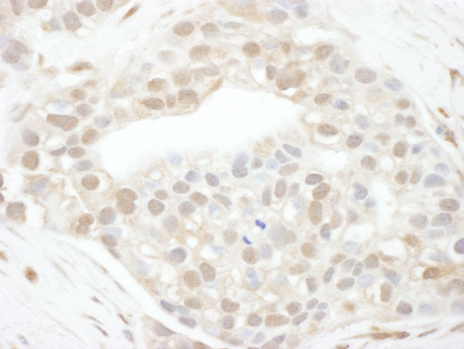 Cyclin T1 Antibody in Immunohistochemistry (Paraffin) (IHC (P))