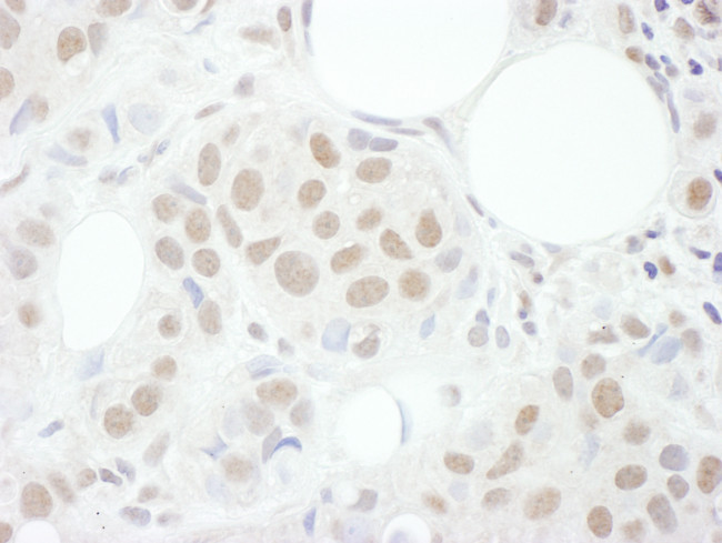 Cyclin T1 Antibody in Immunohistochemistry (Paraffin) (IHC (P))