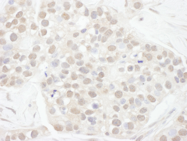 Cyclin T1 Antibody in Immunohistochemistry (Paraffin) (IHC (P))