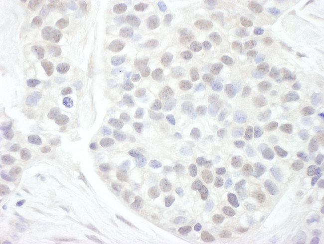 Cyclin T1 Antibody in Immunohistochemistry (Paraffin) (IHC (P))