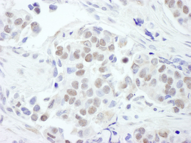 GATA3 Antibody in Immunohistochemistry (Paraffin) (IHC (P))