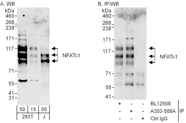 NFATc1 Antibody in Western Blot (WB)