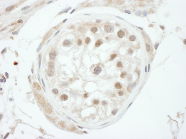 GTF2H1 Antibody in Immunohistochemistry (Paraffin) (IHC (P))