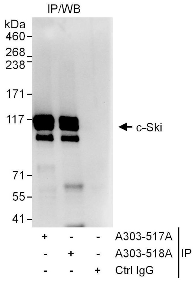 c-Ski Antibody in Immunoprecipitation (IP)