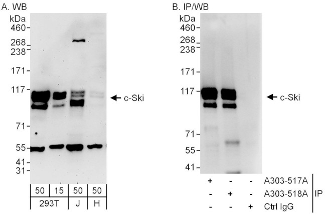 c-Ski Antibody in Western Blot (WB)