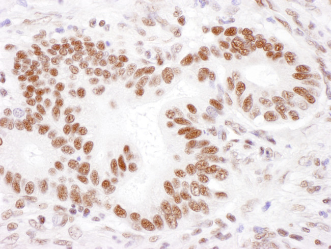 PABPN1 Antibody in Immunohistochemistry (Paraffin) (IHC (P))