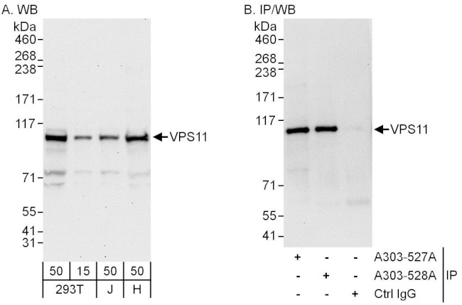 VPS11 Antibody in Western Blot (WB)