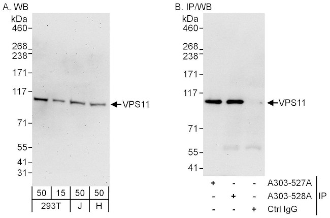 VPS11 Antibody in Western Blot (WB)