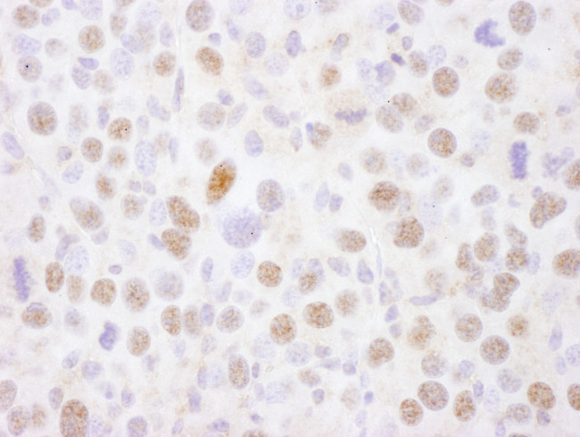 MEF2A Antibody in Immunohistochemistry (Paraffin) (IHC (P))