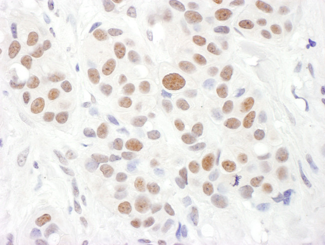 RAP1 Antibody in Immunohistochemistry (Paraffin) (IHC (P))