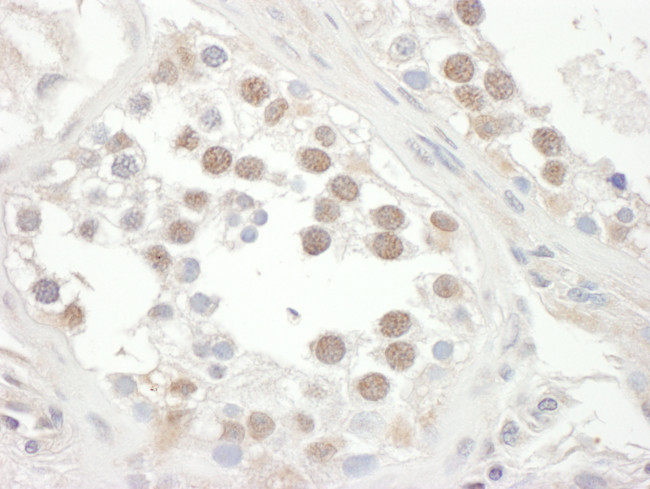 RAP1 Antibody in Immunohistochemistry (Paraffin) (IHC (P))