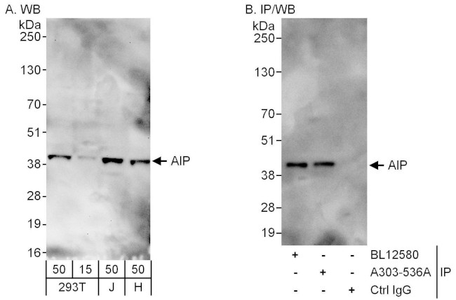 AIP Antibody in Western Blot (WB)