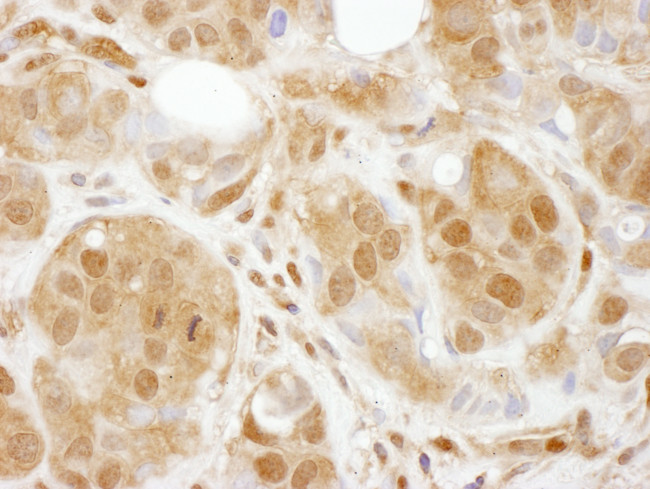 TBP1 Antibody in Immunohistochemistry (Paraffin) (IHC (P))