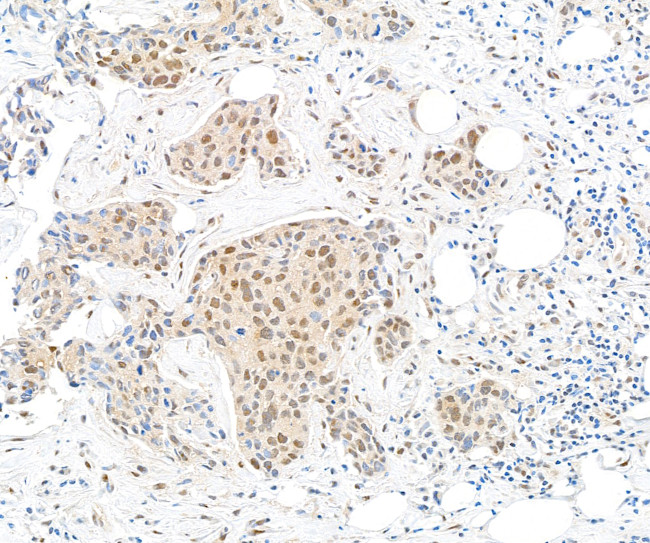 TBP1 Antibody in Immunohistochemistry (Paraffin) (IHC (P))