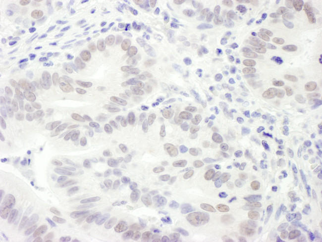 EDD1 Antibody in Immunohistochemistry (Paraffin) (IHC (P))