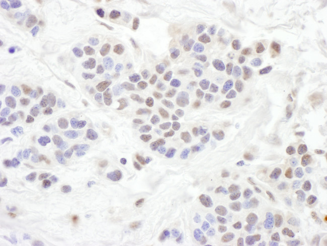 TLE1 Antibody in Immunohistochemistry (Paraffin) (IHC (P))