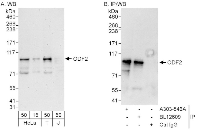 ODF2 Antibody in Western Blot (WB)