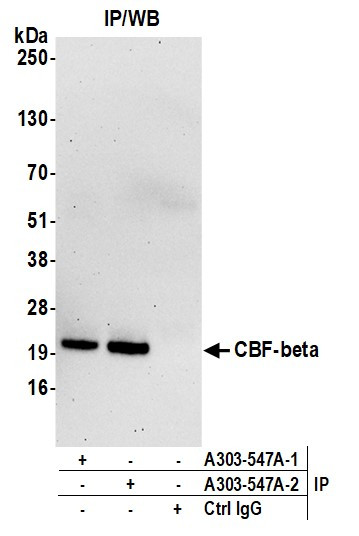 CBF-beta Antibody in Immunoprecipitation (IP)