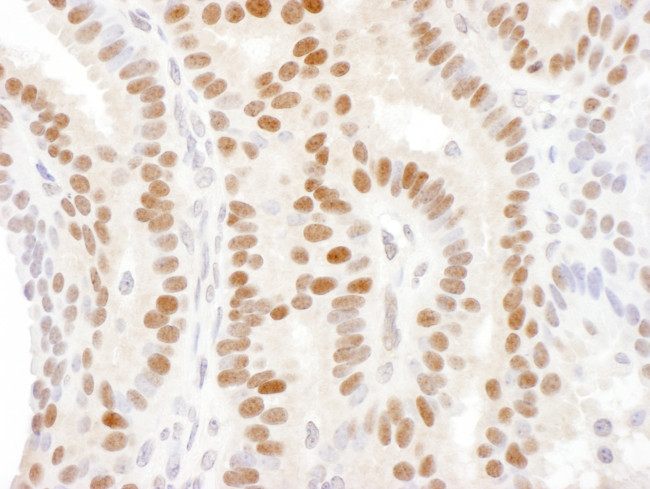 DACH1 Antibody in Immunohistochemistry (Paraffin) (IHC (P))