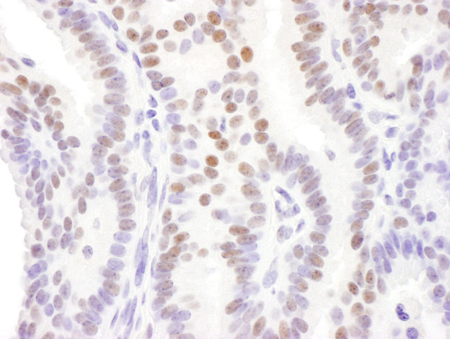 DACH1 Antibody in Immunohistochemistry (Paraffin) (IHC (P))