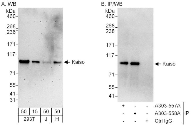 Kaiso Antibody in Western Blot (WB)