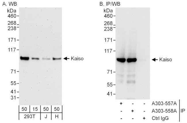 Kaiso Antibody in Western Blot (WB)