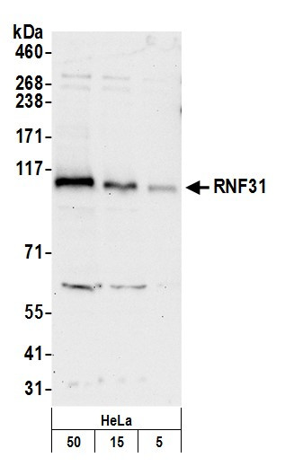 RNF31 Antibody in Western Blot (WB)