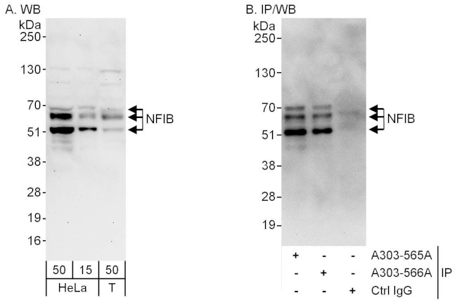 NFIB Antibody in Western Blot (WB)