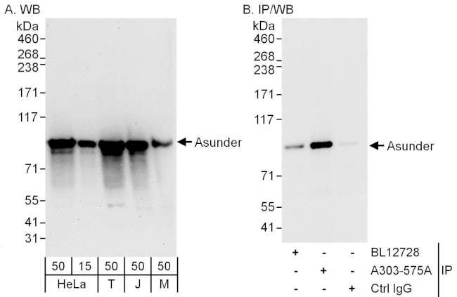 Asunder Antibody in Western Blot (WB)