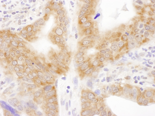 RPL6 Antibody in Immunohistochemistry (Paraffin) (IHC (P))