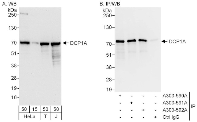 DCP1A Antibody in Western Blot (WB)