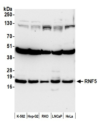 RNF5 Antibody in Western Blot (WB)