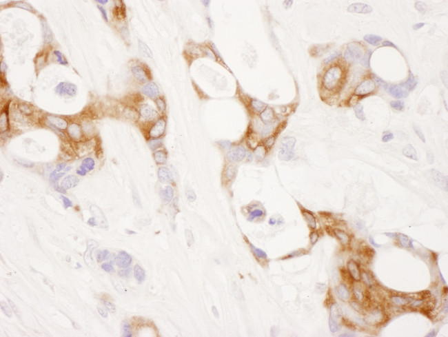 COX-2 Antibody in Immunohistochemistry (Paraffin) (IHC (P))