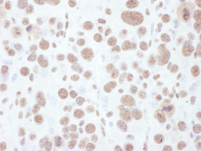 Phospho-MEK1 (Thr286) Antibody in Immunohistochemistry (Paraffin) (IHC (P))