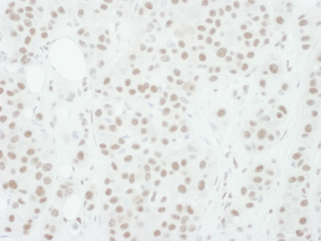 Phospho-MEK1 (Thr286) Antibody in Immunohistochemistry (Paraffin) (IHC (P))