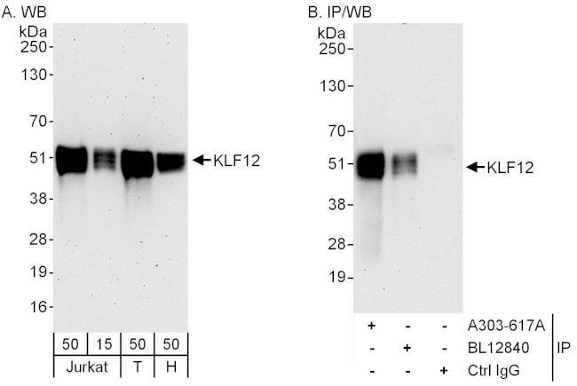 KLF12 Antibody in Western Blot (WB)