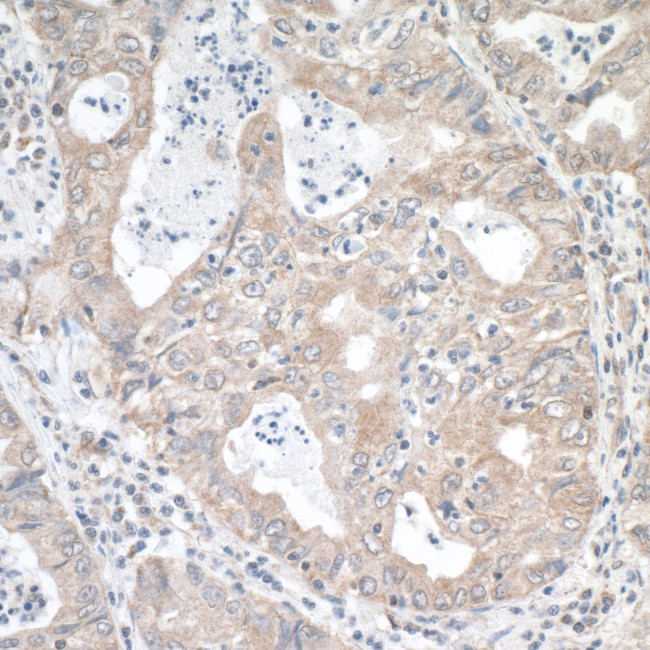 MTHFR Antibody in Immunohistochemistry (Paraffin) (IHC (P))