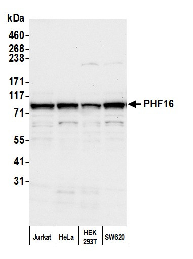 PHF16 Antibody in Western Blot (WB)