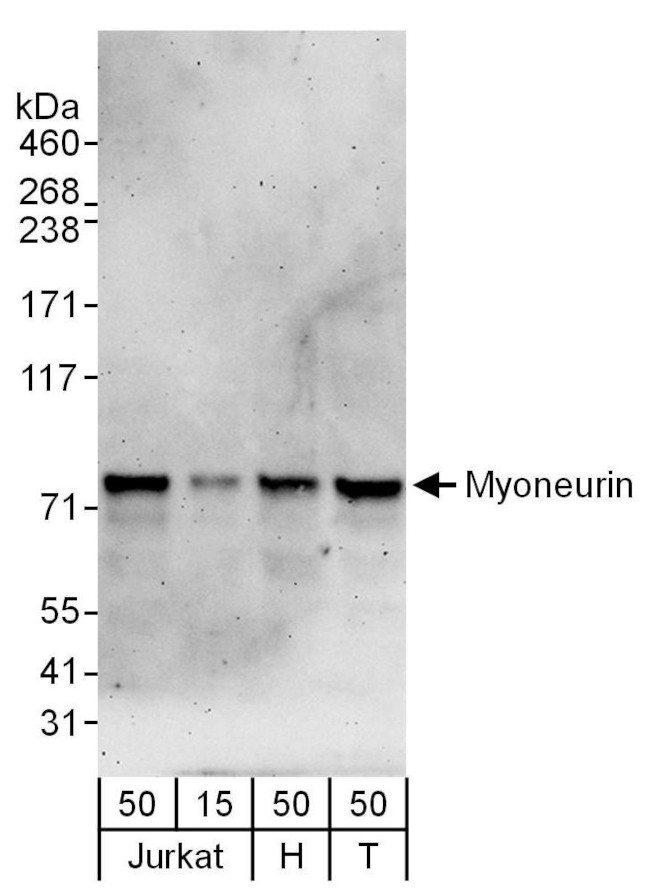 Myoneurin Antibody in Western Blot (WB)