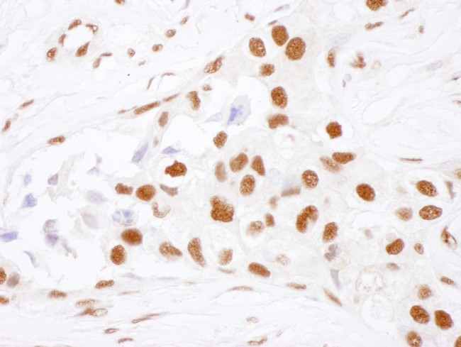 NF90 Antibody in Immunohistochemistry (Paraffin) (IHC (P))