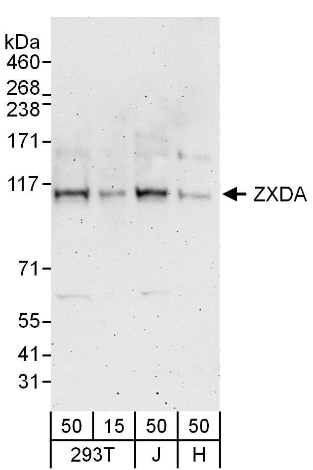 ZXDA Antibody in Western Blot (WB)