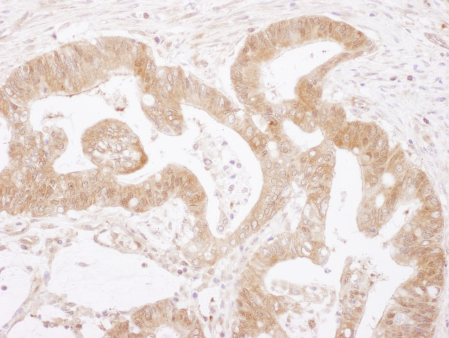 Caspase 3 Antibody in Immunohistochemistry (Paraffin) (IHC (P))