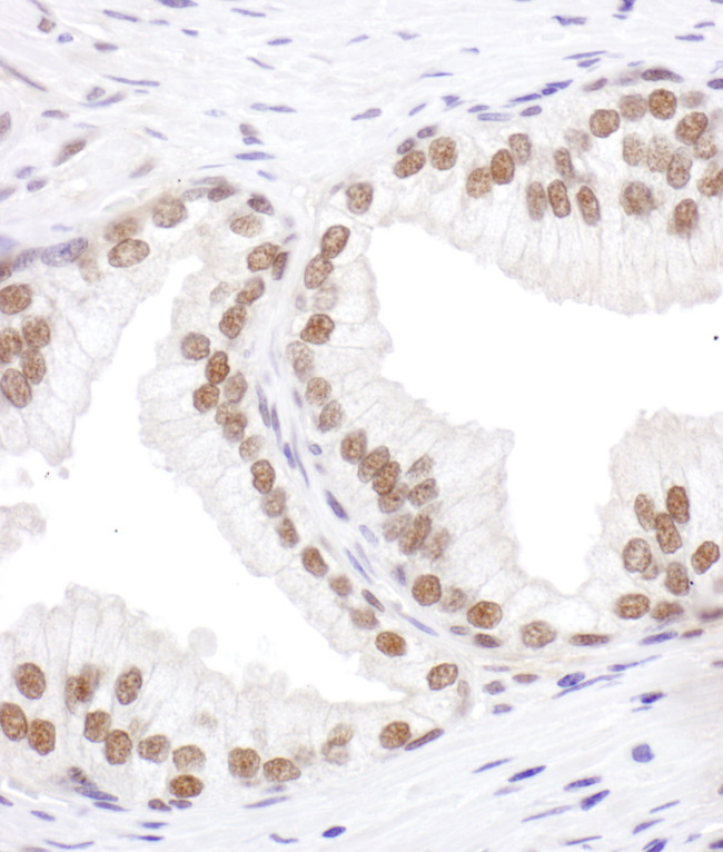 SRp55 Antibody in Immunohistochemistry (Paraffin) (IHC (P))