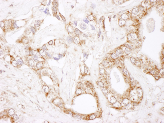 Bcl-2 Antibody in Immunohistochemistry (Paraffin) (IHC (P))