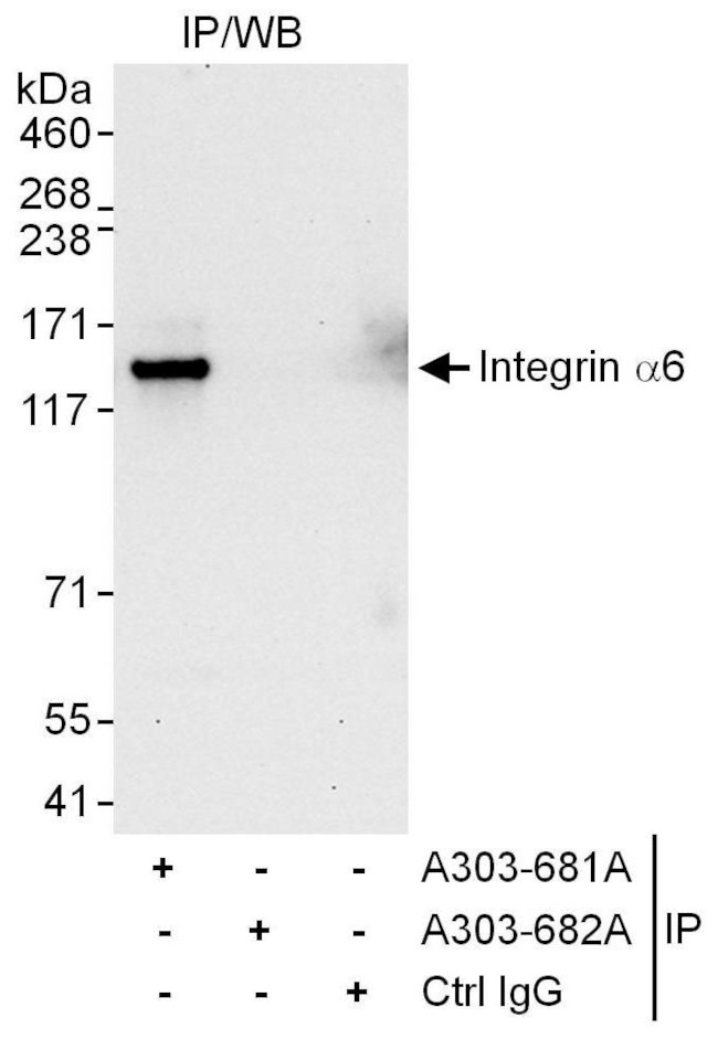 Integrin Alpha 6 Antibody in Immunoprecipitation (IP)