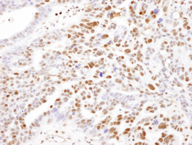 SAMHD1 Antibody in Immunohistochemistry (Paraffin) (IHC (P))