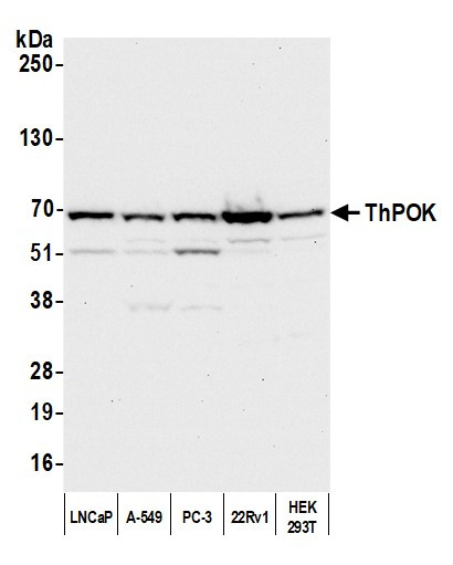 ZBTB7B Antibody in Western Blot (WB)